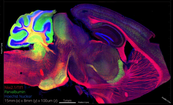 A colorful image of a brainAI-generated content may be incorrect.
